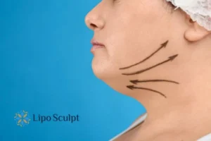 Boost your confidence with a Double chin treatment Garston 
