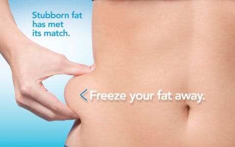 Hips treatment Garston From Lipo Sculpt