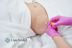 Do you want to know how long Aqualyx Garston results last?