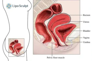 Treatment For A Leaky Bladder 2 How EM Chair treatment Garston can help Leaky bladder issues. Read more now!