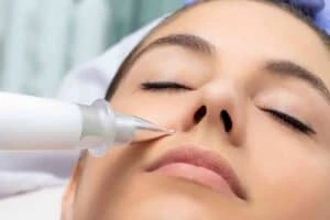Best Actinic Keratoses Removal 3 Actinic keratoses Garston solutions - book in today!